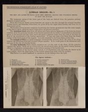 Lumbar Region - no. 1