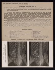 Lumbar Region - no. 2