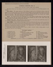 Lumbar Region - no. 4