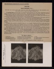 Pelvis. Male Perineum - no. 1