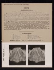 Pelvis. Male Perineum - no. 4