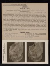 Abdomen. Pelvis - no. 2 (Male)