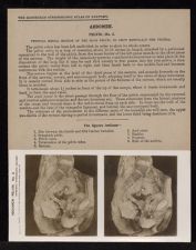 Abdomen. Pelvis - no. 3