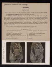 Abdomen. Pelvis - no. 4