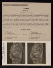 Abdomen. Pelvis - no. 6