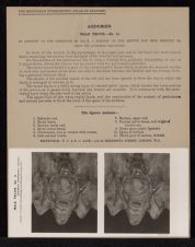 Abdomen. Male Pelvis - no. 11