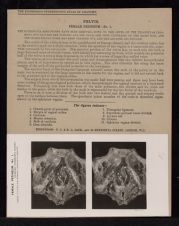 Pelvis. Female Perineum - no. 1