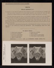 Pelvis. Female Perineum - no. 2