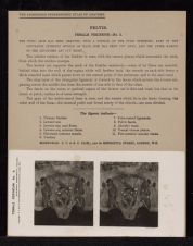 Pelvis. Female Perineum - no. 3