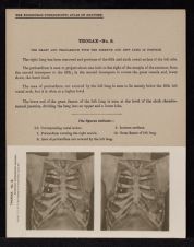 Thorax - no. 8