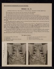 Thorax - no. 10