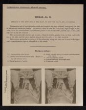 Thorax - no. 11