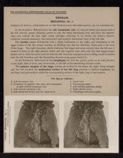 Thorax. Mediastina - no. 1