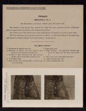 Thorax. Mediastina - no. 3