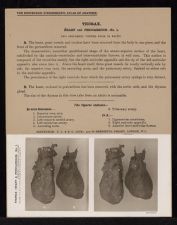 Thorax. Heart and Pericardium - no. 1