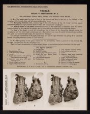 Thorax. Heart and Pericardium - no. 2