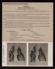 Thorax. Heart and Pericardium - no. 4