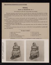 Thorax. Heart and Pericardium - no. 8