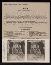 Thorax. Heart and Pericardium - no. 9