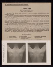 Upper Limb. Surface Anatomy - no. 3