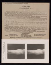 Upper Limb. Surface Anatomy - no. 4