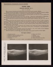 Upper Limb. Surface Anatomy - no. 5