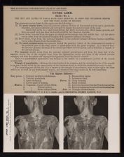 Upper Limb. Back - no. 1