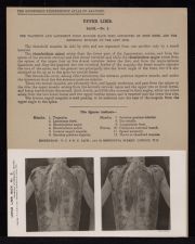 Upper Limb. Back - no. 2