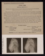 Upper Limb. Scapular Region - no. 1