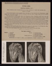 Upper Limb. Scapular Region - no. 2