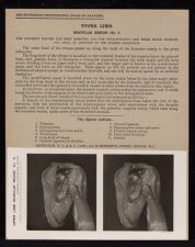 Upper Limb. Scapular Region - no. 3