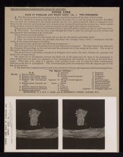 Upper Limb. Back of Forearm and Wrist Joint --no. 1