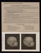 Cranio-Cerebral Topography - no. 1