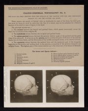 Cranio-Cerebral Topography - no. 2