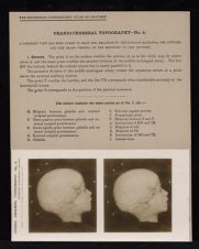 Cranio-Cerebral Topography - no. 4