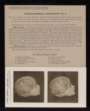 Cranio-Cerebral Topography - no. 5