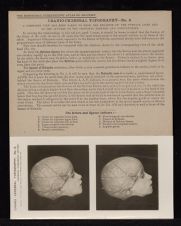 Cranio-Cerebral Topography - no. 6