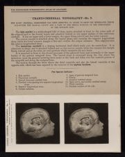 Cranio-Cerebral Topography - no. 7