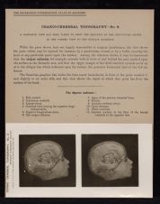 Cranio-Cerebral Topography - no. 8