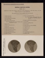 Central Nervous System. Brain - no. 5