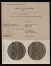 Central Nervous System. Brain - no. 11