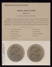 Central Nervous System. Brain - no. 12