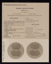 Central Nervous System. Brain - no. 14