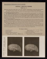 Central Nervous System. Brain - no. 17