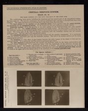 Central Nervous System. Brain - no. 20