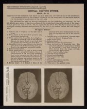 Central Nervous System. Brain - no. 22
