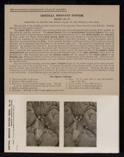 Central Nervous System. Brain - no. 23