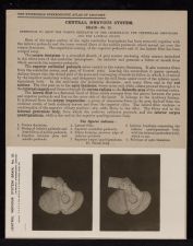 Central Nervous System. Brain - no. 25