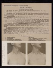 Head and Neck. Surface Anatomy - no. 1