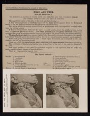 Head and Neck. Side of Neck - no. 1